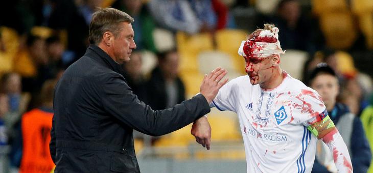 Защитник киевского «Динамо» получил страшную травму